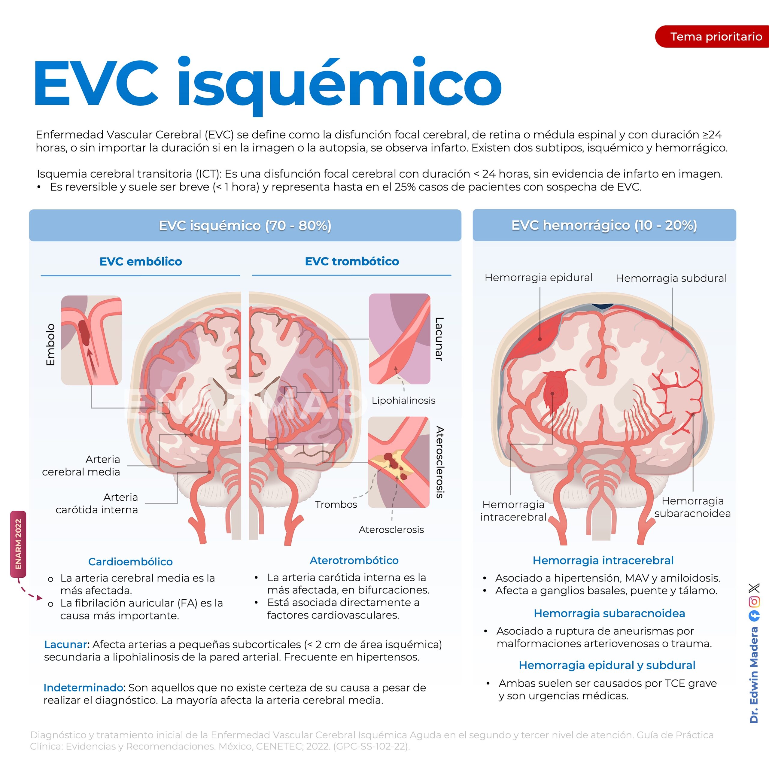 EVC isquémica 1