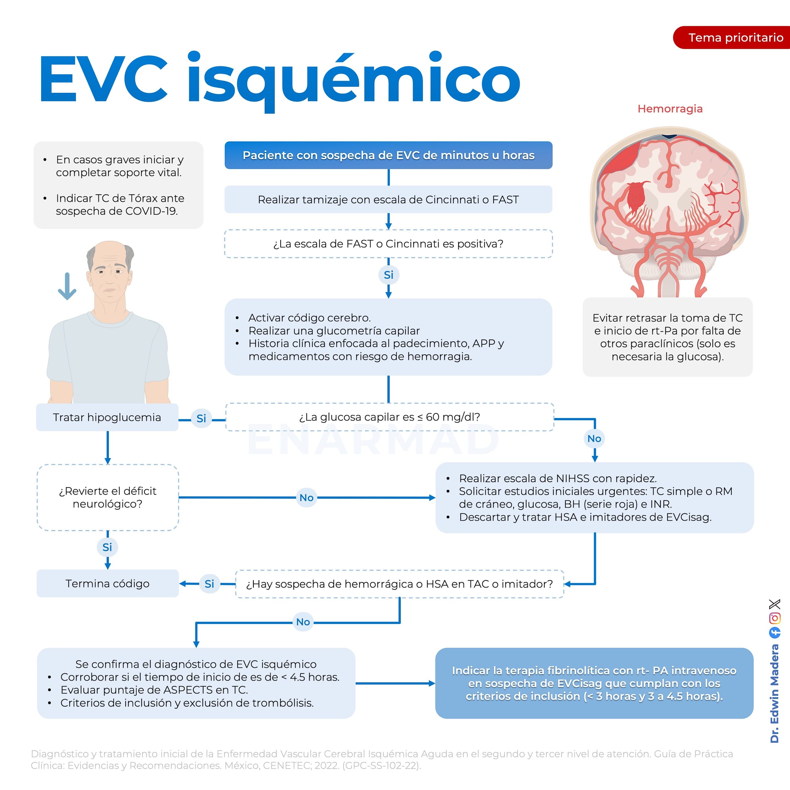 EVC isquémica 8