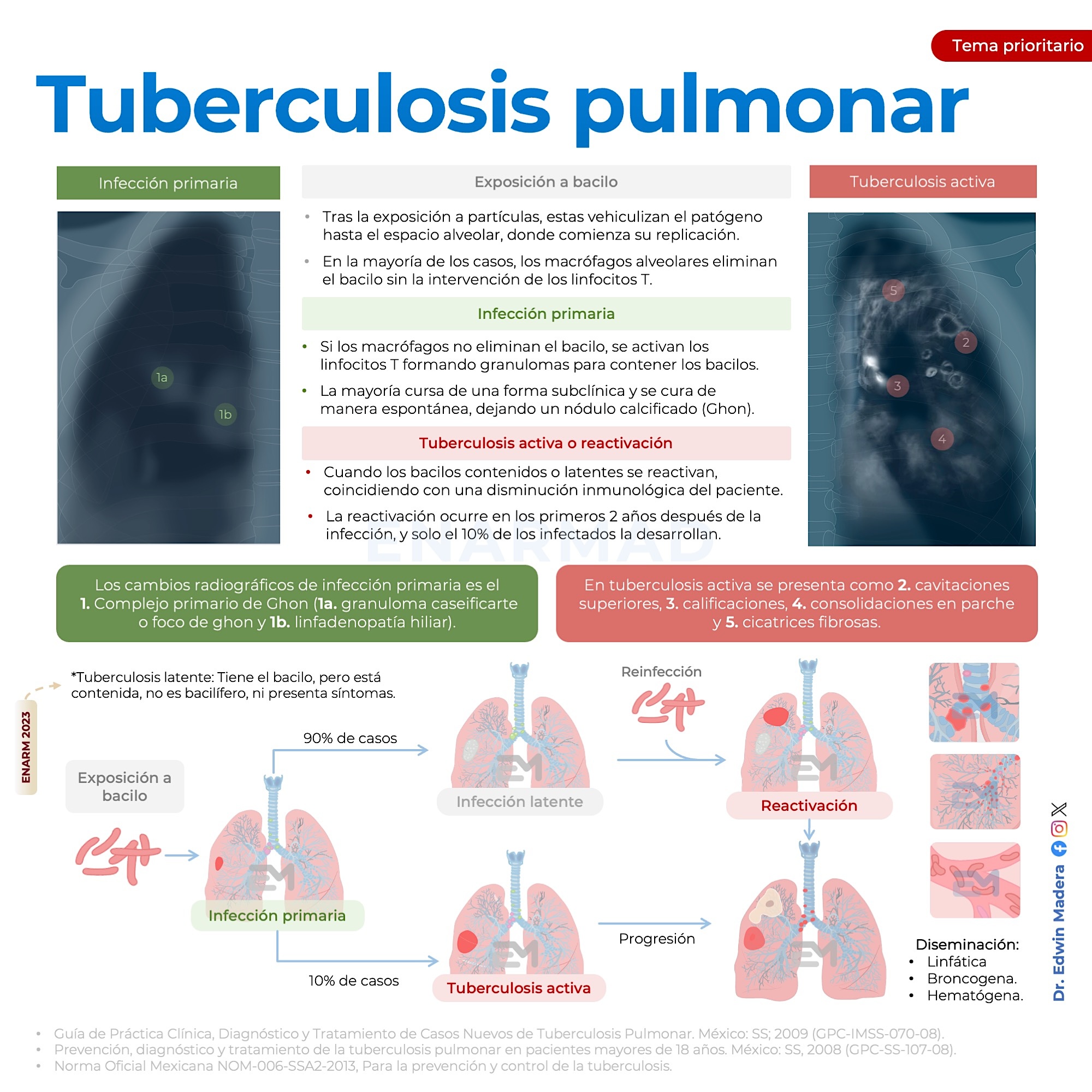 Tuberculosis pulmonar2 5°